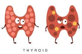 The Beginning of a Long Journey to Thyroid Health